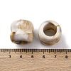 Two Tone Opaque Acrylic Beads OACR-Z025-01B-3