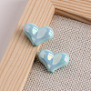 Electroplate Opaque Acrylic Beads MACR-WH0010-38H-1