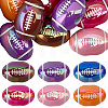20Pcs UV Plating Opaque Acrylic Beads MACR-SC0002-73-1